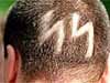 Skinhead